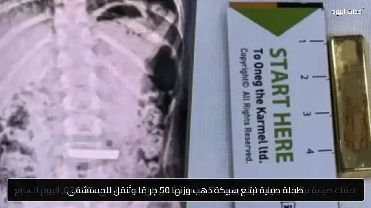 طفلة صينية تبتلع سبيكة ذهب وزنها 50 جرامًا وتُنقل للمستشفى
