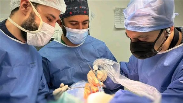 لأول مرة بمجمع الإسماعيلية الطبي.. استئصال ورم بقاع الجمجمة بتقنية متقدمة ضمن التأمين الصحي الشامل