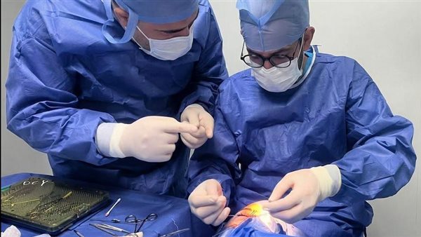 نجاح جراحة دقيقة لإصلاح القنوات الدمعية في مستشفى رمد قلاوون
