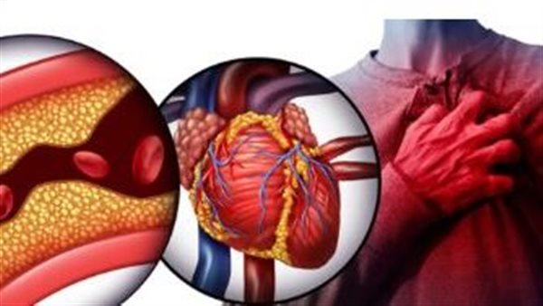 أطعمة طبيعية تساهم في خفض الكوليسترول الضار