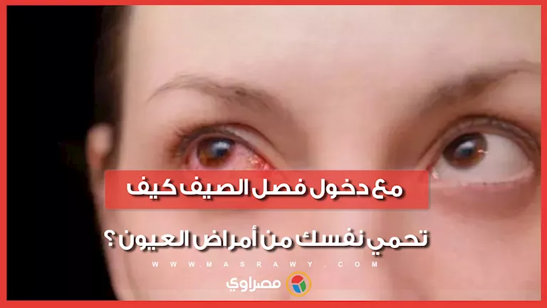 كيفية حماية عينيك من الأمراض خلال فصل الصيف