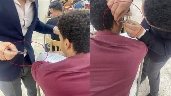 استخراج سماعة غش من أذن طالب حقوق في أسيوط