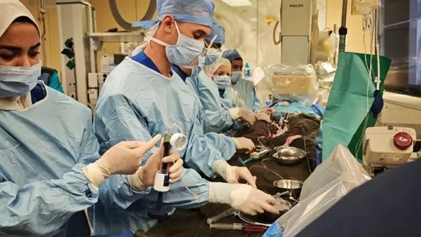 فريق طب قصر العيني يبتكر تقنية فونتان عبر القسطرة
