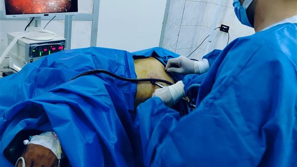 نجاح أول جراحة بالمنظار لاستئصال الكلية اليسرى والمرارة في الشرقية